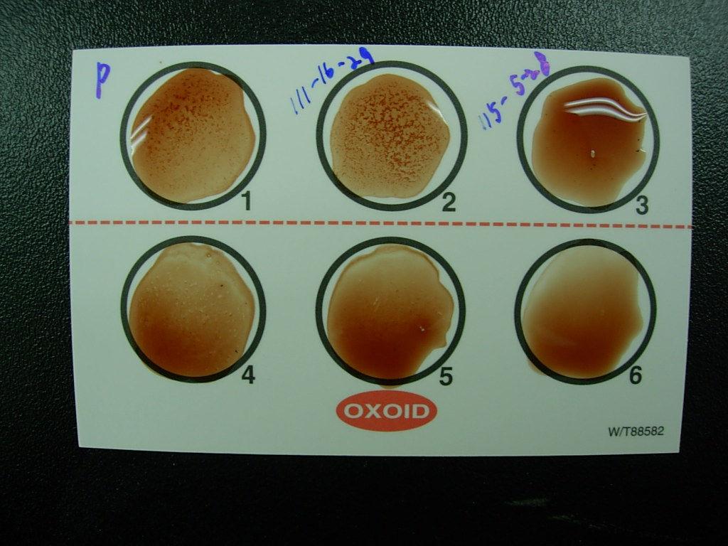 reagent와동시실험함 test reagent control reagent ( 항상음성 ) *Baird-parker Agar: -coagulase-positive staphylococci -egg yolk