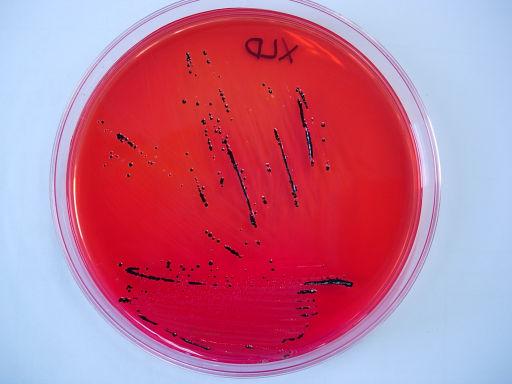 * Enzymatic chromogenic substrate 사용으로집락자체만색깔을띄므로 color diffusion, color overlap 살모넬라용 CHROM agar