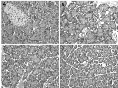 소회향과금은화추출물의급성췌장염에대한예방효과 43 Fig. 7. Effects of Foeniculum and Lonicera extract on the IL-6 concentration. before 2hrs 2hrs 8. 광학현미경결과 정상군에서는정상적인췌장조직소견을보였다 (Fig. A).