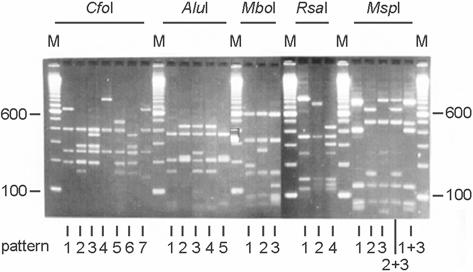 Multi-drug Resistant Acinetobacter baumannii 23 후 4 에서중합반응을종료시켰다. 반응후생성된산물은 1.