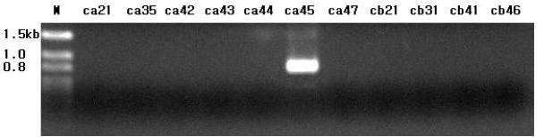 pneumoniae는 TEM+SHV형의특성을가졌기때문에 2균주 (a21, ca21, b41, cb41) 와 (a45, ca45) 1 균주를선택하여해당 ESBL 염기서열을분석하였고그결과, TEM형의경우이들의부모효소인 TEM-1과완전히일치되었고 SHV형은 SHV-12와완전히일치되었다.