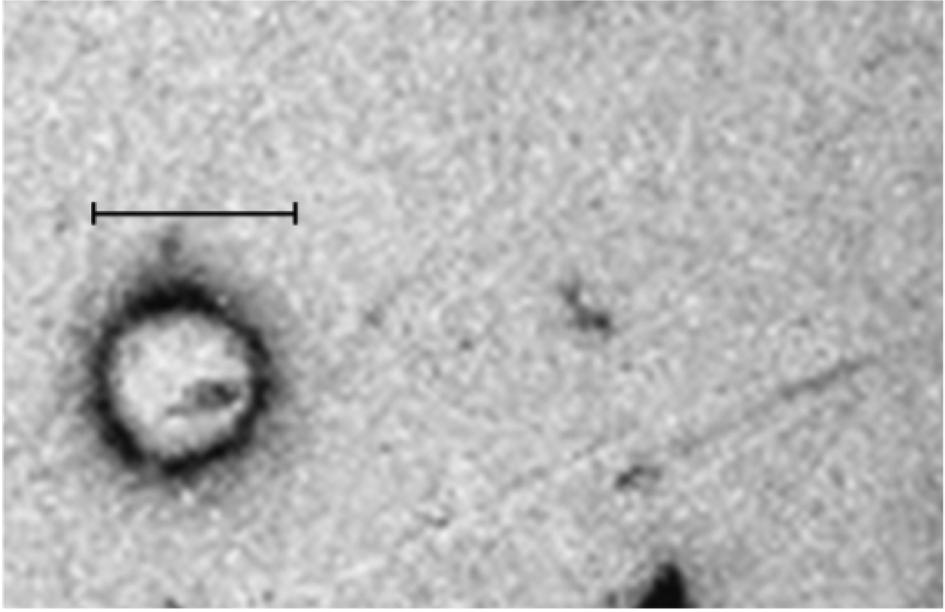 ½ Á Á Á½w Á½ xá xá Á x Á Á x Fig. 1. The nanoparticles of lecithin by TEM. TEM micrograph of nanoparticle from Acer mono sap by lecithinencapsulation. Scale of bar is 200.