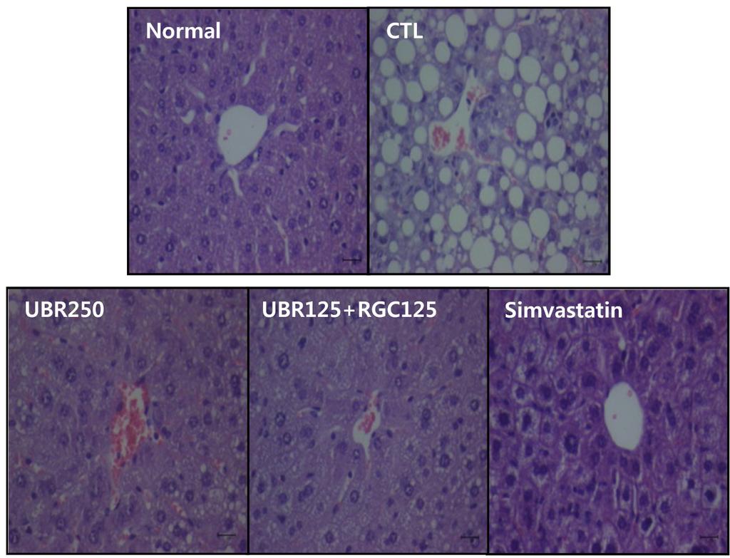 복분자와홍삼의콜레스테롤개선효과 1495 Non-alcoholic steatohepatitis (NAH) score 8 6 4 2 0 d a Normal CTL UBR250 UBR125+ simvastatin RG125 c Fig. 1. NAH score and histologic findings of liver tissue y the extracts of unripe lack rasperry and red ginseng treatment in hyperlipidemic mice fed the HCD for 12 weeks.