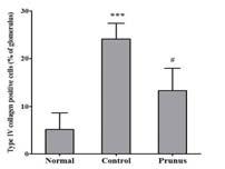 Effects of Prunus on renal trnasforming growth factor (TGF-β1) expression in