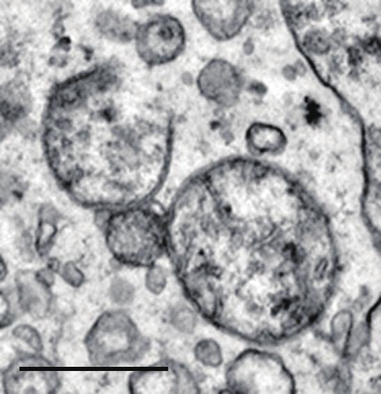 또한 적정 농도 이상의 아연에 노출된 대복의 경우 17일 경과하면서 100% 폐사하였고(Ju et al., 2006), 담수어류인 yellow tail lambari도 노출 후 24시간 째 50-100% 폐사율을 보였다(Santos et al., 2011).