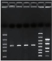 Cloning recovery cloning (Fig. 3) Spin column comparison (Fig. 2) Cloning recovered PCR amplicons (Fig.