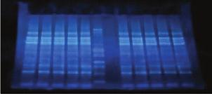 별도의염색없이바로 b 확인가능 : 일반 Transilluminator에 2분 긴보관기간 : 4 에서 18개월 ( 실온에서 6개월 ) 3분이면전기영동완료 : high voltage 전기영동가능 다양한전기영동장치에적용가능 : 다양한 size의 gel 보유, 현재사용하고있는전기영동장치에바로적용 다양한전기영동 buffer 사용가능 : 목적에따라 MES,