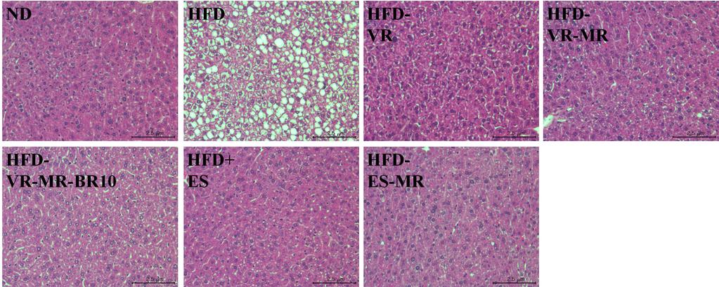 커피의 비만억제 및 지질저하 효과 Tale 4. Effect of hot-water extracts from various coffee eans on liver and adipose tissue weight in mice fed experimental diets for 6 weeks Groups1) -BR10 Liver (g) 2)*** 4.64±0.