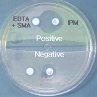 그림 11. Metallo-β-lactamase 검출을위한 Double disk synergy 시험. Imipnem (IPM) 디스크와 EDTA + SMA 디스크사용.