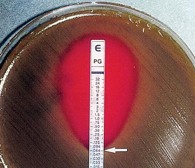 그림 9. Etest strip 을이용한 Streptococcus pneumoniae 에대한 penicillin G