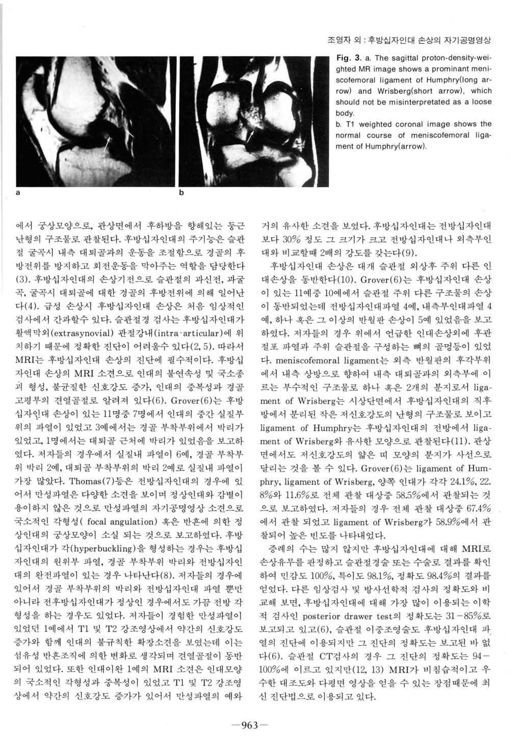 초영자외 후방십자인대손상의자기공명영상 Fig. 3. a.