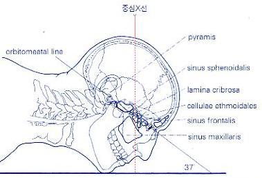 Round foramen( 정원공 ) Petrous ridge( 추체 ) 가 Maxillary sinus 밑에.