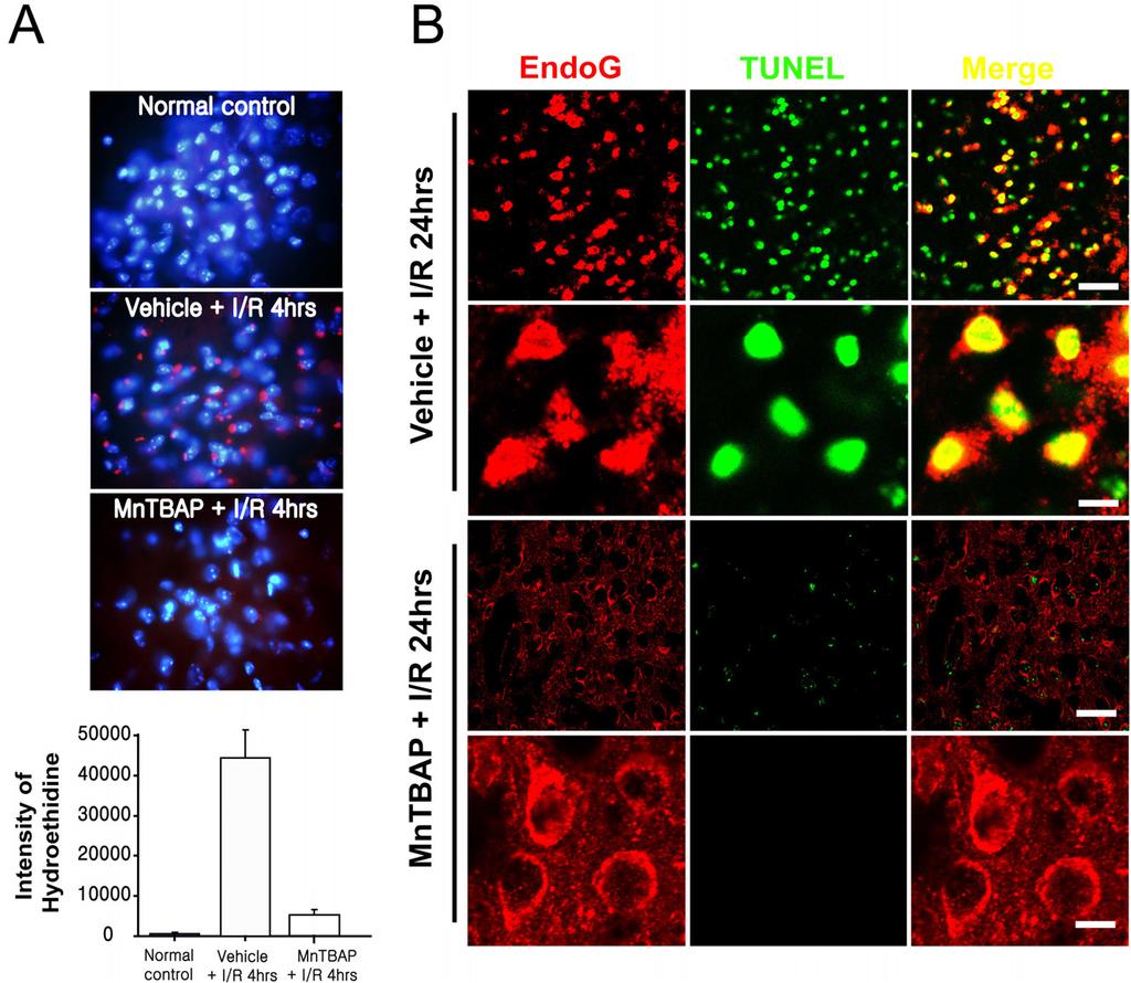 김현우조경주김현정조양제이병인김경환 Figure 3. The effect of MnTBAP on ROS production and on an apoptotic cell death.