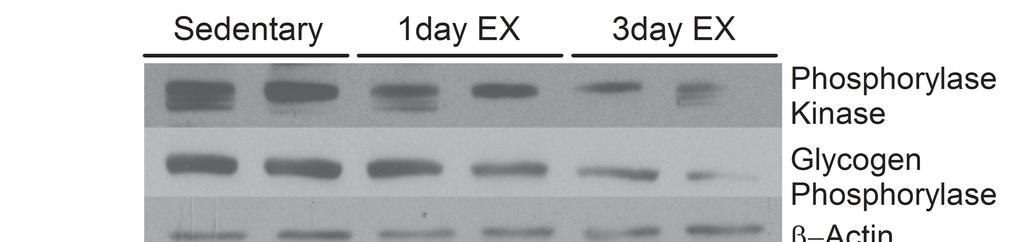 284 골격근내 PGC-1α 발현이 글리코겐 분해효소와 해당효소 발현에 미치는 영향 7. Western Blotting 적출된 조직은 RIPA buffer[50 mmol/ℓ Tris HCl(pH 7.4), 1 % NP-40, 0.