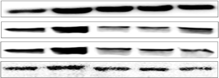 fusiformis with/without lti i teri on inos expression in LPS-stimulte RAW264.7 mrophges.