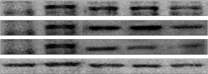 fusiformis with/without lti i teri on COX-2 expression in LPSstimulte RAW264.7 mrophges.