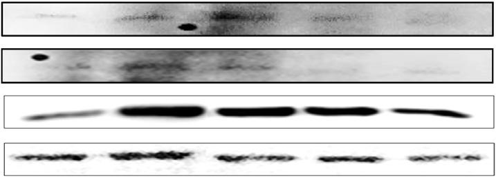 The expression levels of IL-6 in mrna n protein levels were etermine using RT-PCR n western lotting. Mens with the ifferent letters (-) ove the rs re signifintly ifferent (P<.