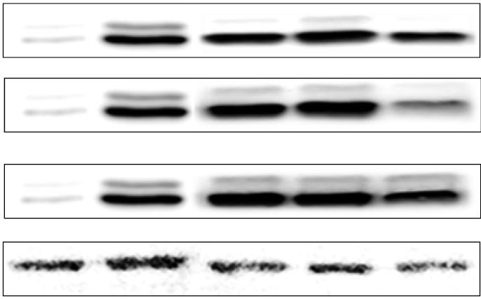 1456 권명숙 문옥주 배민주 이슬기 김미향 이상현 유기환 김육용 공창숙 No teri Weissell sp. SH-1 A L. sei β-atin p-erk protein expression (/β-tin). 5 No teri Weissell sp. SH-1 L. sei No teri Weissell sp. SH-1 B L.