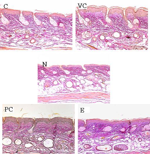 130 Figure 2. Histological observation on SKH-1 hairless mice skin after 4-week experiment to evaluate the inhibitory effect of Gardeniae fructus water extract on skin aging. Van Gieson's stain, 100.