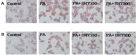 엄은식외 1 명 : Palmitic acid 로지방축적을유도한 HepG2 cell 에대한삼황사심탕과대황황련사심탕의효과연구 (71) Fig. 7. Oil Red O staining of HepG2 Cells. PA 300 μm for 24 h induced lipid accumulation in HepG2 cells.