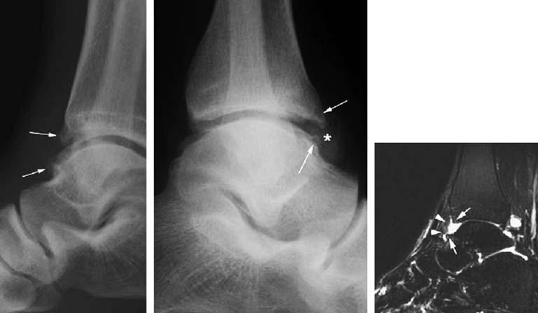 Hip & Ankle Arthroscopy A B C Fig. 2.