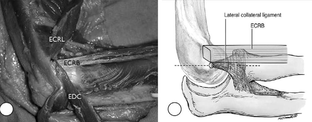 제 2 회관절경수술심포지엄 A B Fig. 1. Anatomical relationship (A) between extensor carpi radialis longus, brevis and digitorum communis and (B) lateral collateral ligament.