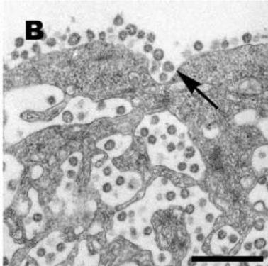 (hantaviruses), 아레나바이러스 (arenaviruses)) 검출을위한유전자진단법 (Polymerase chain reaction, PCR) 과세균들 (yersinia, mycoplasma, chlamydia, legionella, Coxiella burnetii, spotted fever and typhus group rickettsiae)