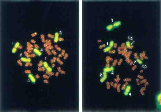 그림 8-16 형광소식자로보합된세포분열중기염색체 (FISH 기법 ) ( 좌 )1 번, 2 번, 4 번염색체가각각 2 개씩관찰되는정상세포 ( 우 ) 염색체전좌부위가화살표로표시된손상세포 대부분의검사실에서사용하는프로토콜은크기가큰염색체 3 개를선택하여형광염색하고판독하는 방법이다.