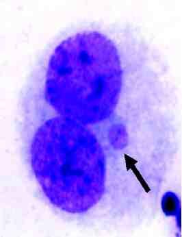 제 8 장 _ 피폭방사선량평가 3) Cytokinesis-block micronucleus(cbmn) 분석손상에서회복되지않은 DNA와세포분열이상으로잘못분열된염색체는전체염색체의소실을유발할수도있고무동원염색체파편을생산할수도있다. 세포분열이상은키네토코어 (kinetochore) 의손상이나방추사의결함이주요원인이다.