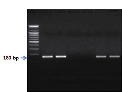 Ⅱ. 종특이프라이머를이용한유전자증폭 PCR 제 2 장 S 1 2 3 4 5 6 그림