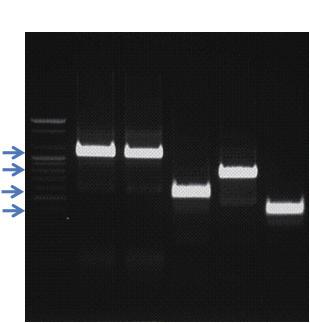 Ⅲ. 일반 universal Ⅱ. 프라이머를이용한유전자증폭 PCR 3. 3. PCR 반응결과 제 3 장 S 1 2 3 4 5 그림 123.