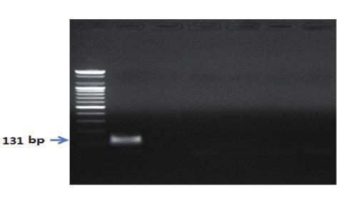 Ⅱ. 종특이프라이머를이용한유전자증폭 PCR 1. 4.