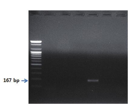 lane 6 말 S 1 2 3 4 5 6 그림 4. 염소프라이머를이용한 PCR 결과.