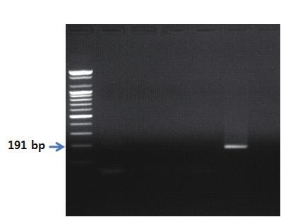 Ⅱ. 종특이프라이머를이용한유전자증폭 PCR 제 2 장 S 1 2 3 4 5 6 그림 5.
