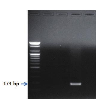 Ⅱ. 종특이프라이머를이용한유전자증폭 PCR 제 2 장 S 1 2 3 4 그림 12. 칠면조프라이머를이용한 PCR 결과.