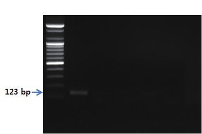 Ⅱ. 종특이프라이머를이용한유전자증폭 PCR 제 2 장 S 1 2 3 4 5 그림 34.