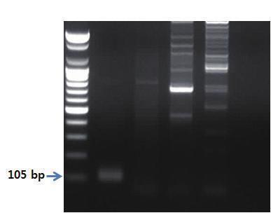 Ⅱ. 종특이프라이머를이용한유전자증폭 PCR 2. 3.