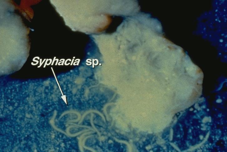 Syphacia spp.