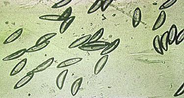 Syphacia spp.