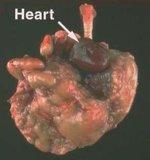 Mycoplasma pulmonis Gross findings - Usually none - Exudate in middle ears - Dilation of airways