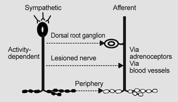 Complex Regional Pain Syndrome Figure 4. Possible couplings between sympathetic neurons and afferent neurons.