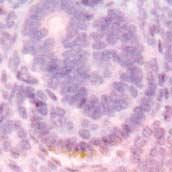24 Fig. 1. Glomerular epithelial cell protein-1 (GLEPP1) expression in developing glomeruli.