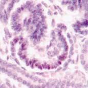 () ut, it is restricted to glomerular epithelial cells through capillary-loop stage.
