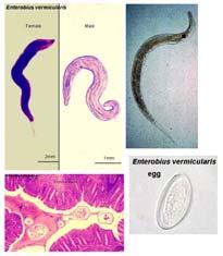 Enterobius vermicularis 요충