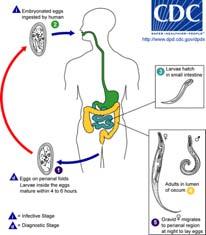 cecum http://www.gastrolab.