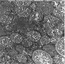 Number of autophagosomes were analyzed from three separate images per each mouse liver. Mean ± SEM (n = 6 per group).