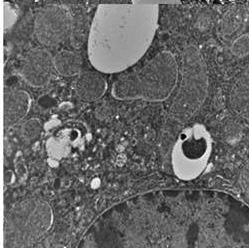 Number of A autophagosome/image 7 6 5 4 3 2 1 0 b a a Relative mitochondiral B DNA content in liver 1.4 1.2 1 0.8 0.6 0.4 0.