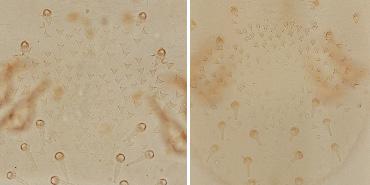 Reemerging skin disease caused by arthropods I: scabies 의학강좌 Bare area A B Figure 3. Dorsal surface of Saroptes canis without bare area (A) and Sarcoptes scabiei with bare area (B). 많다 [11].