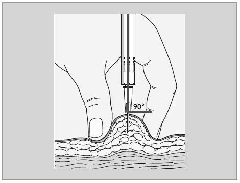 이상열 : 인슐린의종류와특징 Recommended technique for the subcutaneous injection of insulin 5-12 mm Textbook of Diabetes, 4 th ed.