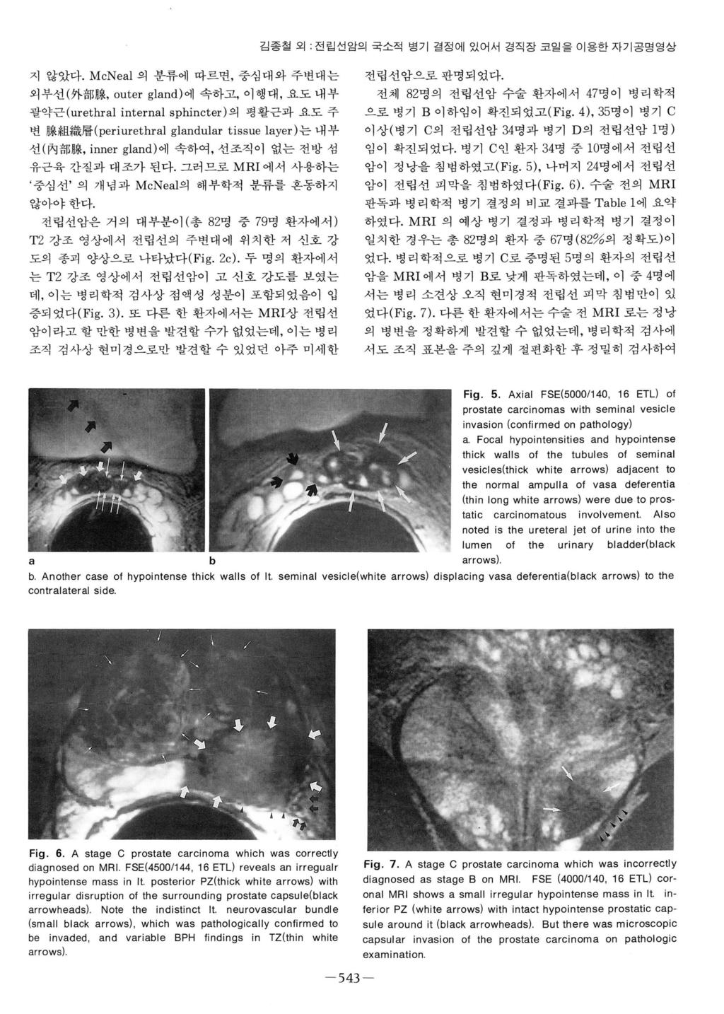 김종철외. 전립선암의국소적병기결정에있어서경직장코일을이용한자기공명영상 지않았다.